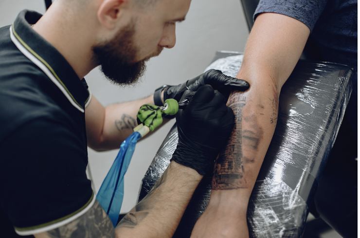 Laser Tattoo Removal